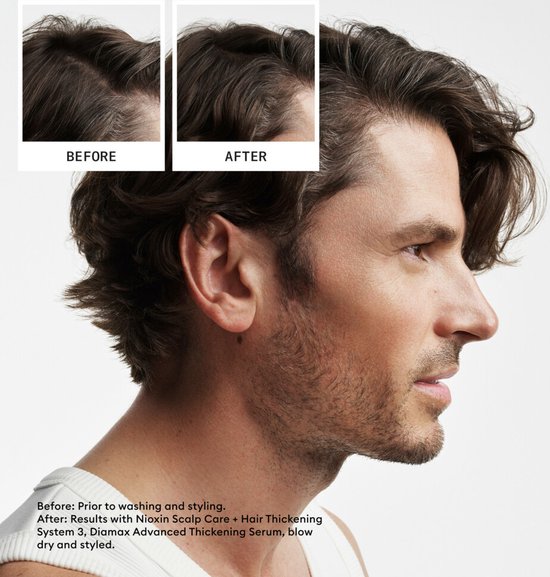 Nioxin System 2 – Loyalty Kit - voor Natuurlijk Haar - Anti Haaruitval – Gevorderde Uitdunning – 300+300+100ml - afbeelding 5